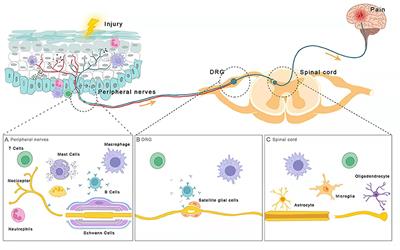 Potential Neuroimmune Interaction in Chronic Pain: A Review on Immune Cells in Peripheral and Central Sensitization